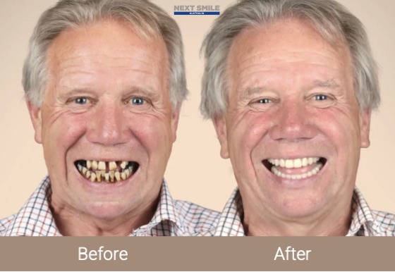 Dental 4