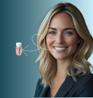 Single Dental Implant